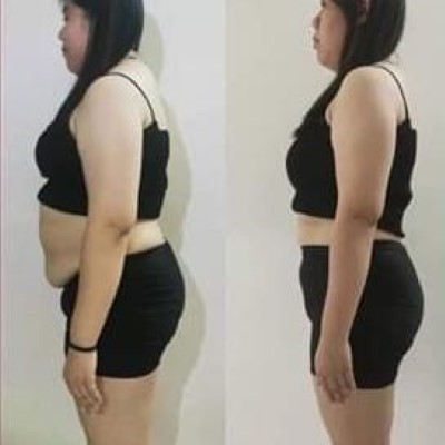 TCM Slimming